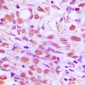 Anti-SENP2 Antibody